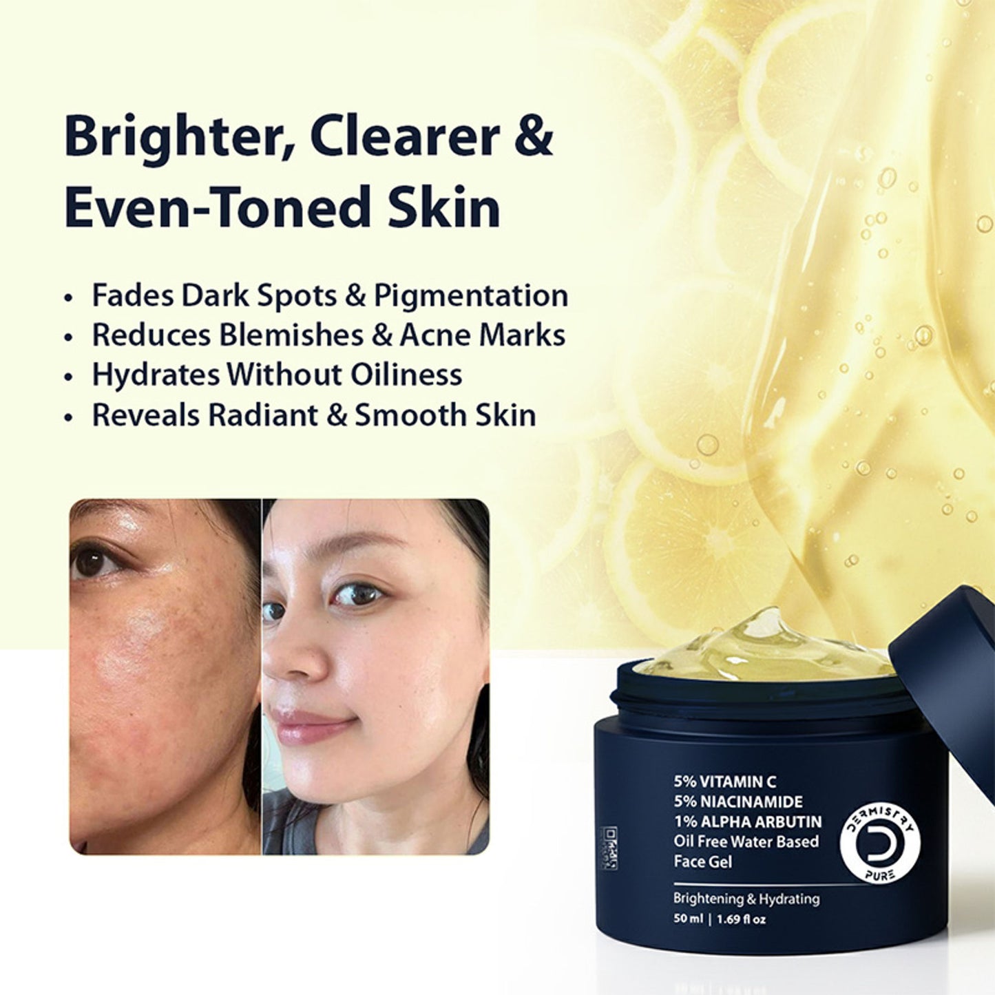 DERMISTRY Vitamin C Oily Skin Moisturizer Face Gel With Niacinamide Alpha Arbutin For Glowing Skin