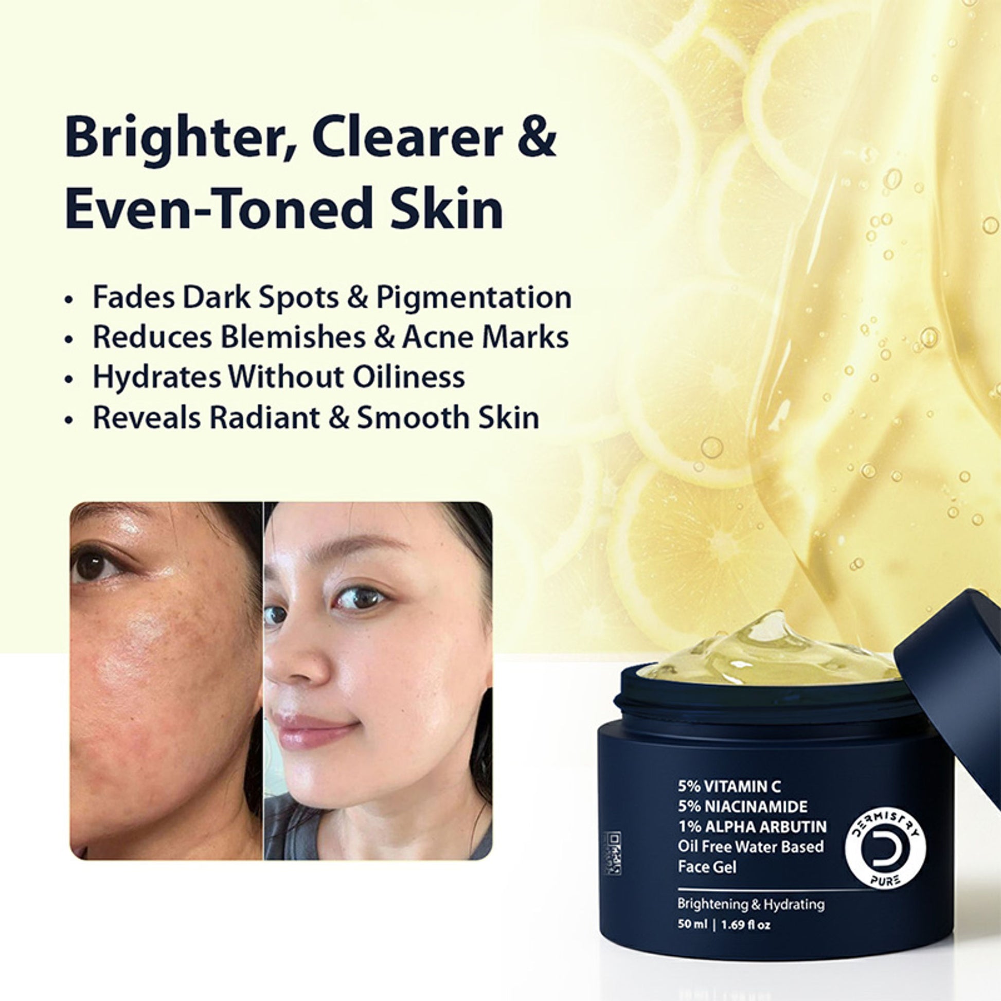DERMISTRY Vitamin C Oily Skin Moisturizer Face Gel With Niacinamide Alpha Arbutin For Glowing Skin