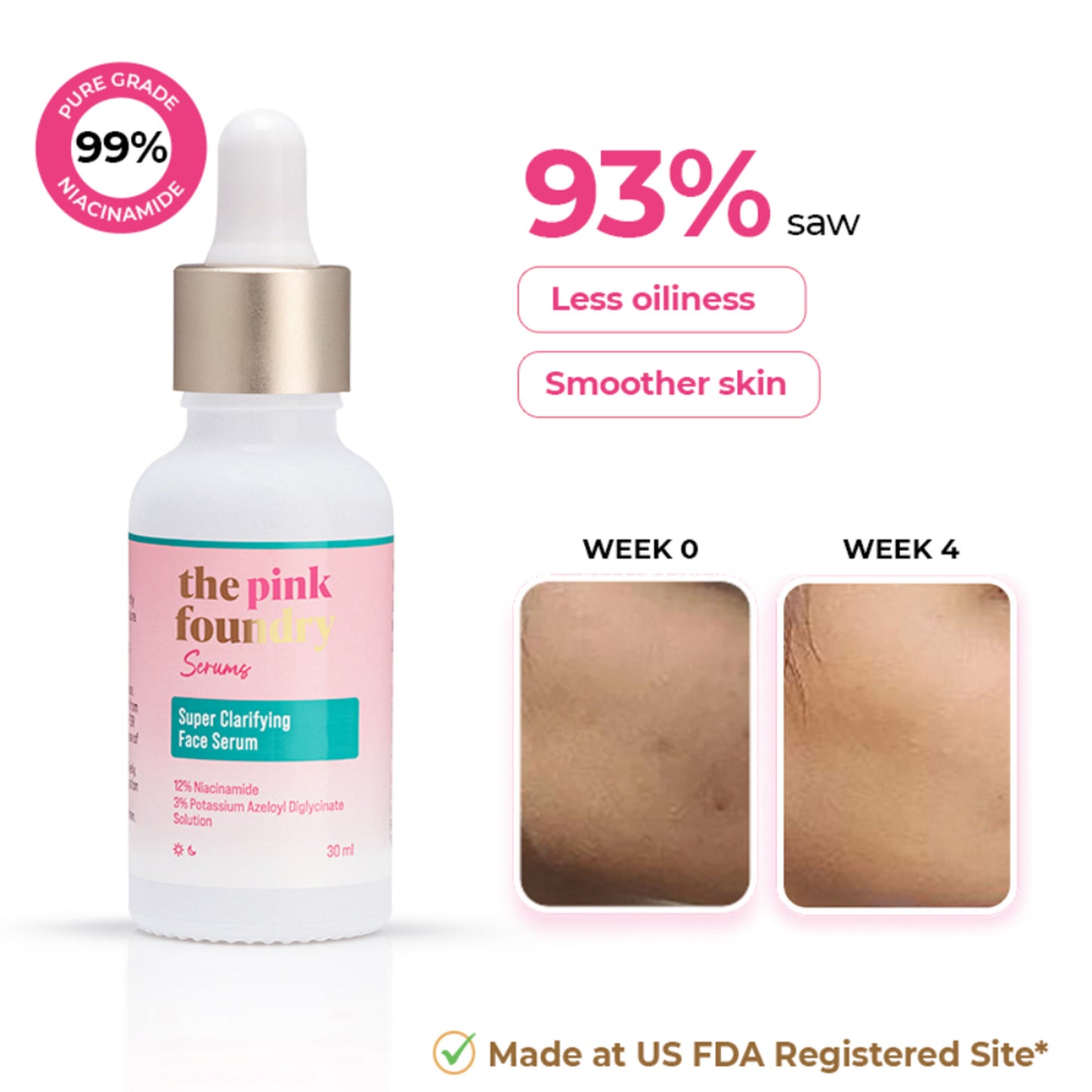 The Pink Foundry 12% Niacinamide Serum - Evens Skin Texture, Controls Excess Oil & Refines Pores