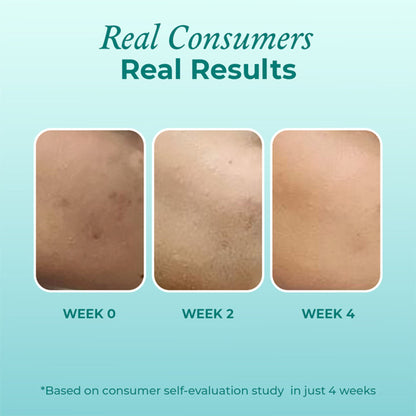 The Pink Foundry 12% Niacinamide Serum - Evens Skin Texture, Controls Excess Oil & Refines Pores
