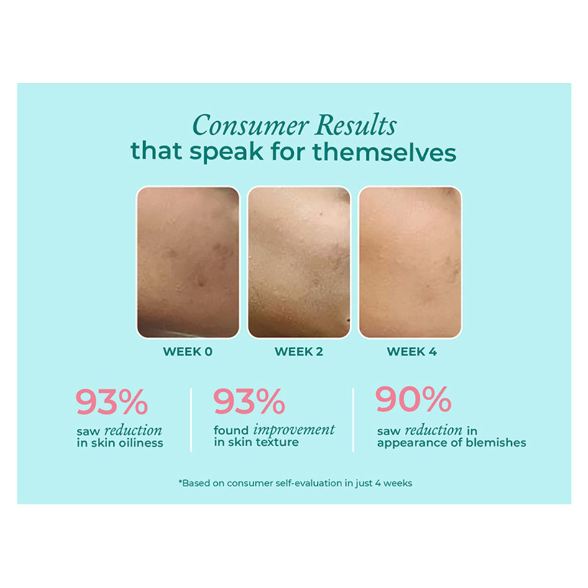 The Pink Foundry 12% Niacinamide Serum - Evens Skin Texture, Controls Excess Oil & Refines Pores