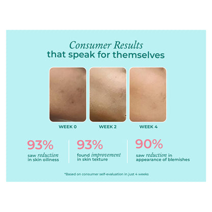 The Pink Foundry 12% Niacinamide Serum - Evens Skin Texture, Controls Excess Oil & Refines Pores