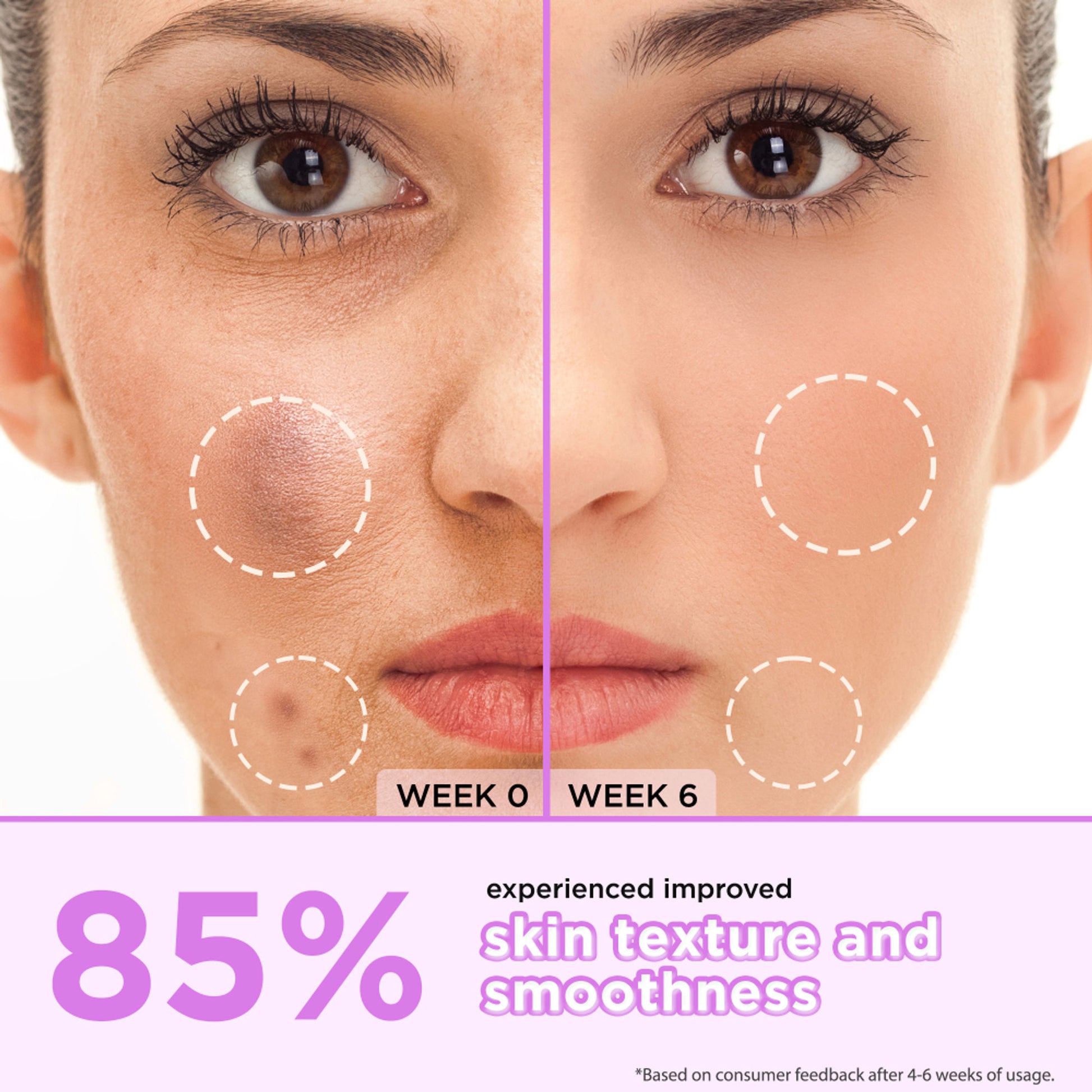 Orgatre 10% Glycolic Acid, 2% Kojic Acid Dark Spot Serum- Brightens Skin & Reduces Hyperpigmentation