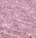 Glitter Rock