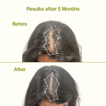 Amright Root Stimulating Elixir With Rootbitec