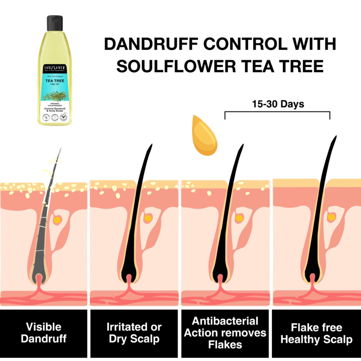 Soulflower Tea Tree Hair Oil - For Scalp And Dandruff Care