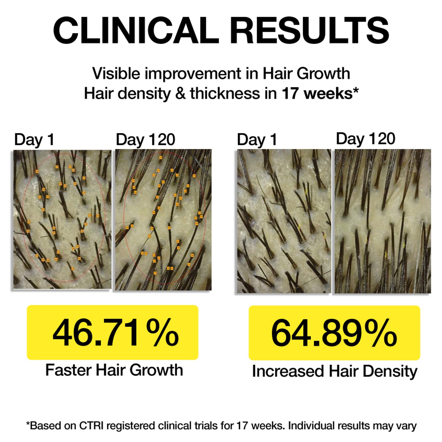 Soulflower Hair Growth Serum - Redensyl, Rosemary, Melanogray, Anagain - Anti Greying Booster