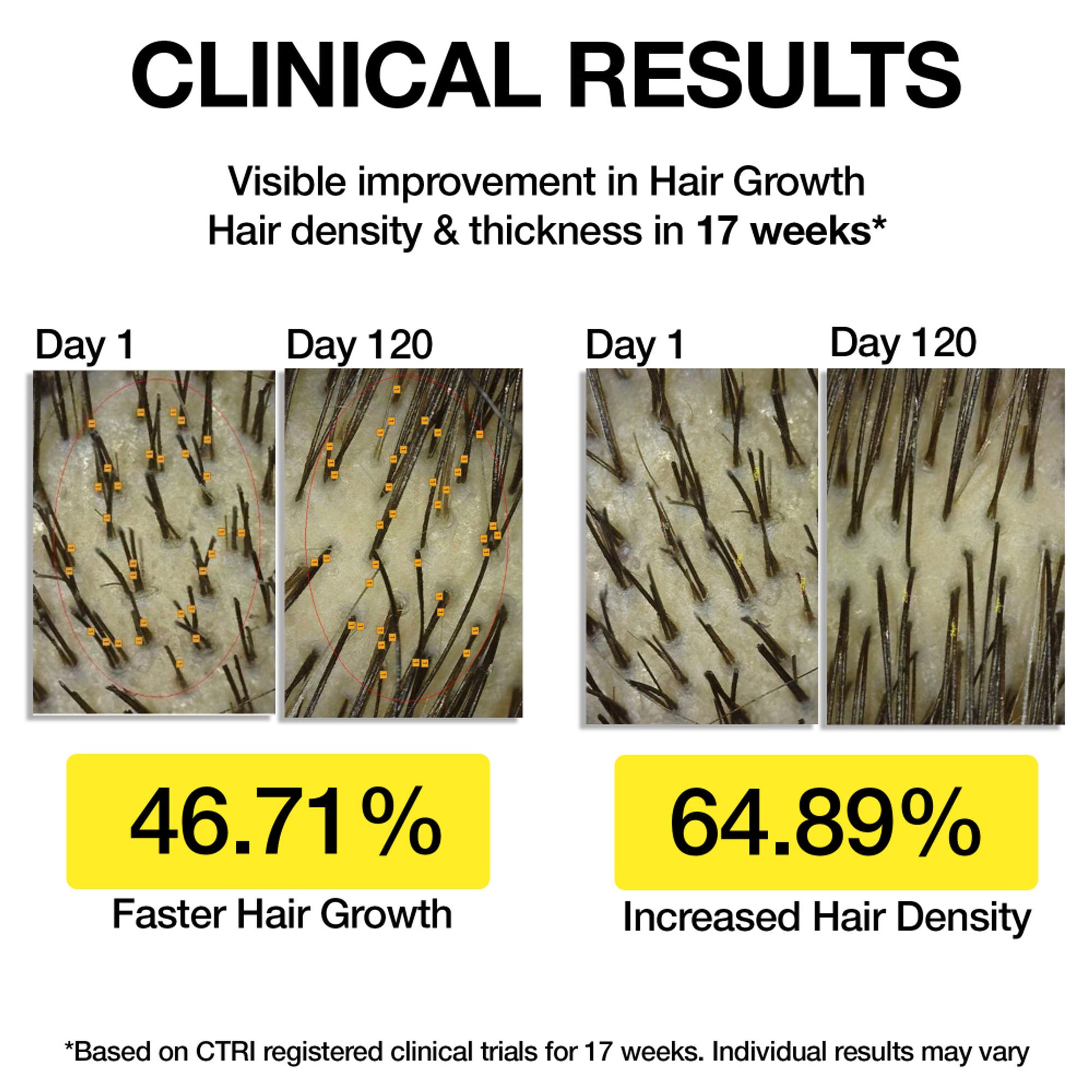 Soulflower Hair Growth Serum - Redensyl, Rosemary, Melanogray, Anagain - Anti Greying Booster