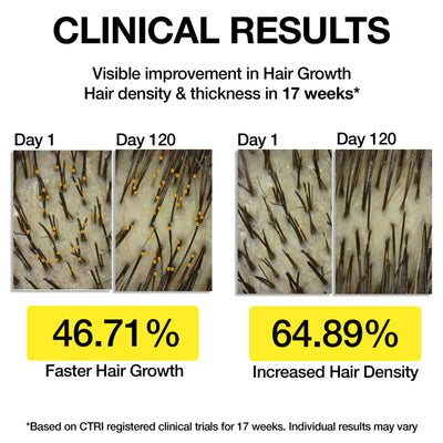 Soulflower Hair Growth Serum - Redensyl, Rosemary, Melanogray, Anagain - Anti Greying Booster
