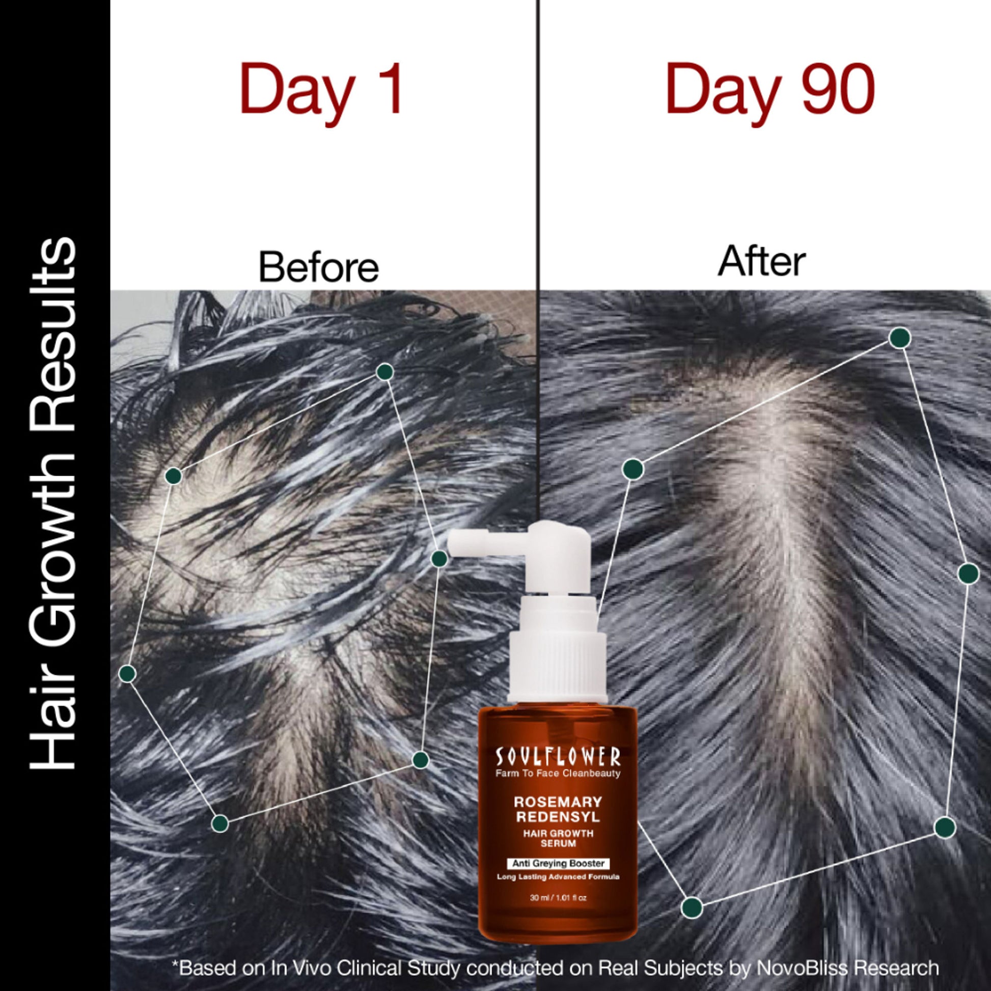 Soulflower Hair Growth Serum - Redensyl, Rosemary, Melanogray, Anagain - Anti Greying Booster