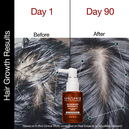 Soulflower Hair Growth Serum - Redensyl, Rosemary, Melanogray, Anagain - Anti Greying Booster