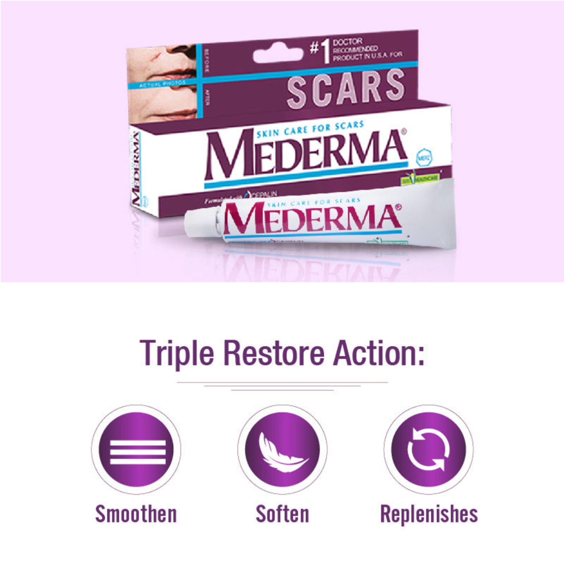 Mederma Scar Gel