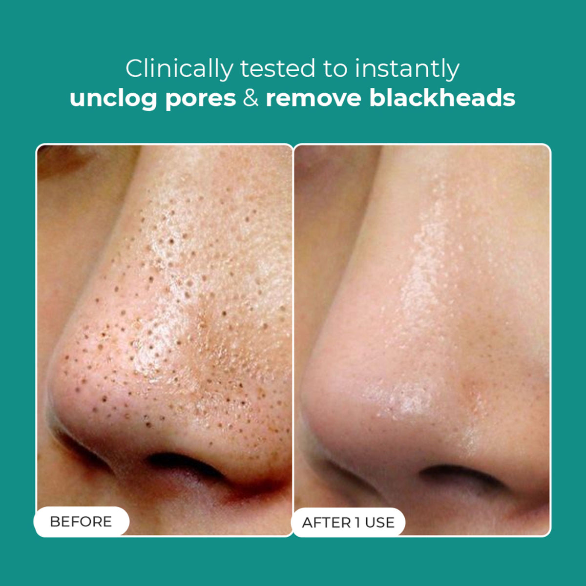 Conscious Chemist Blackhead Melting Water Mini