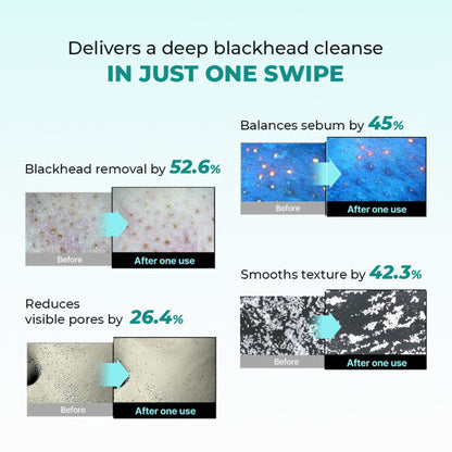 Conscious Chemist Blackhead Melting Water Mini