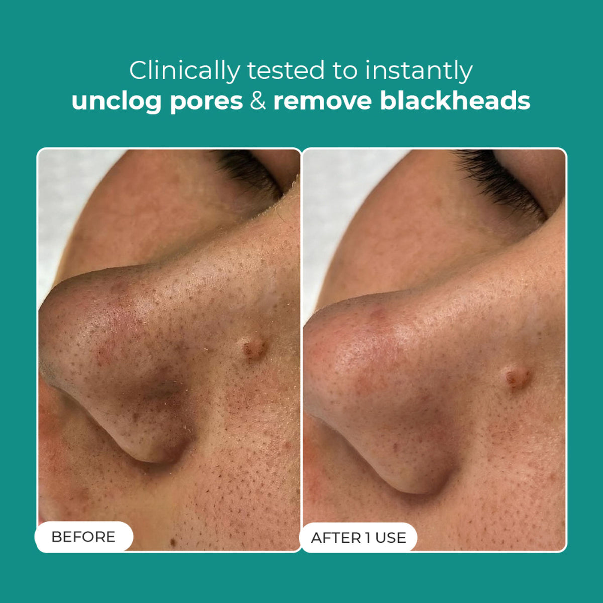 Conscious Chemist Blackhead Melting Water Mini