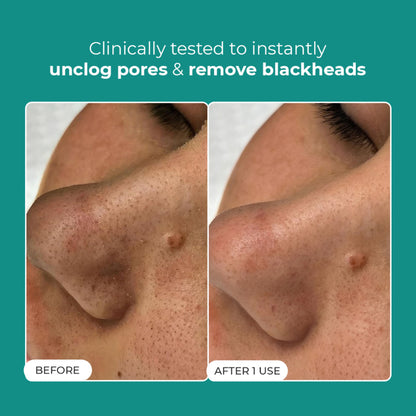 Conscious Chemist Blackhead Melting Water Mini