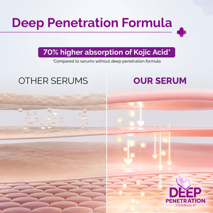 The Derma Co 2% Kojic Acid Face Serum for Dark spots reduction, Pigmentation & Blemishes