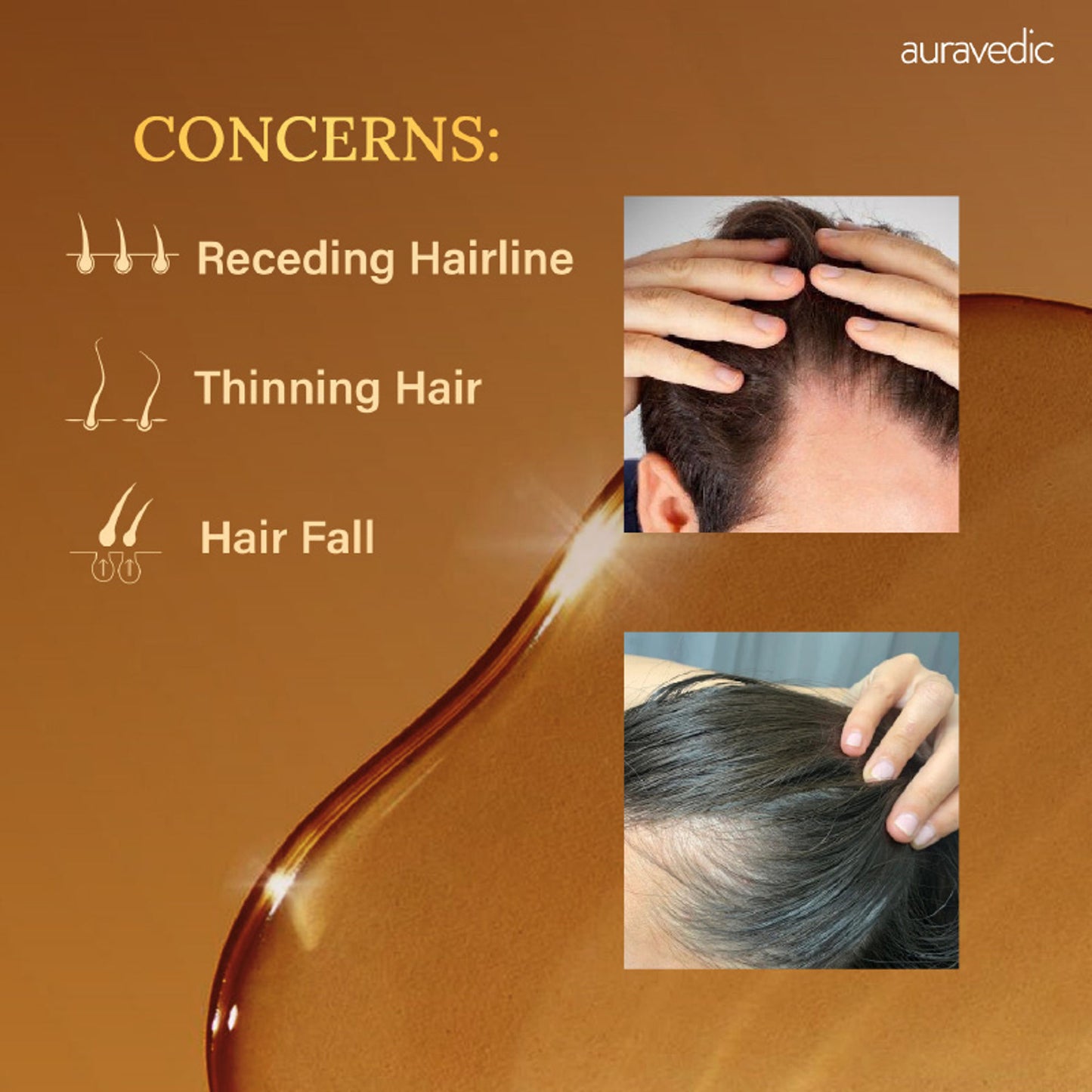 Auravedic Rosemary Hair Oil for Hair Fall with Rosemary Oil for Hair Growth