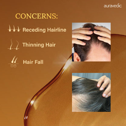 Auravedic Rosemary Hair Oil for Hair Fall with Rosemary Oil for Hair Growth
