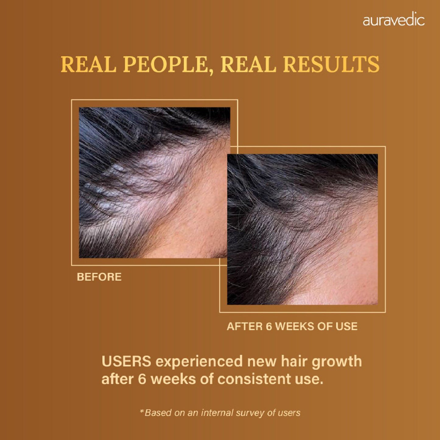 Auravedic Rosemary Hair Oil for Hair Fall with Rosemary Oil for Hair Growth