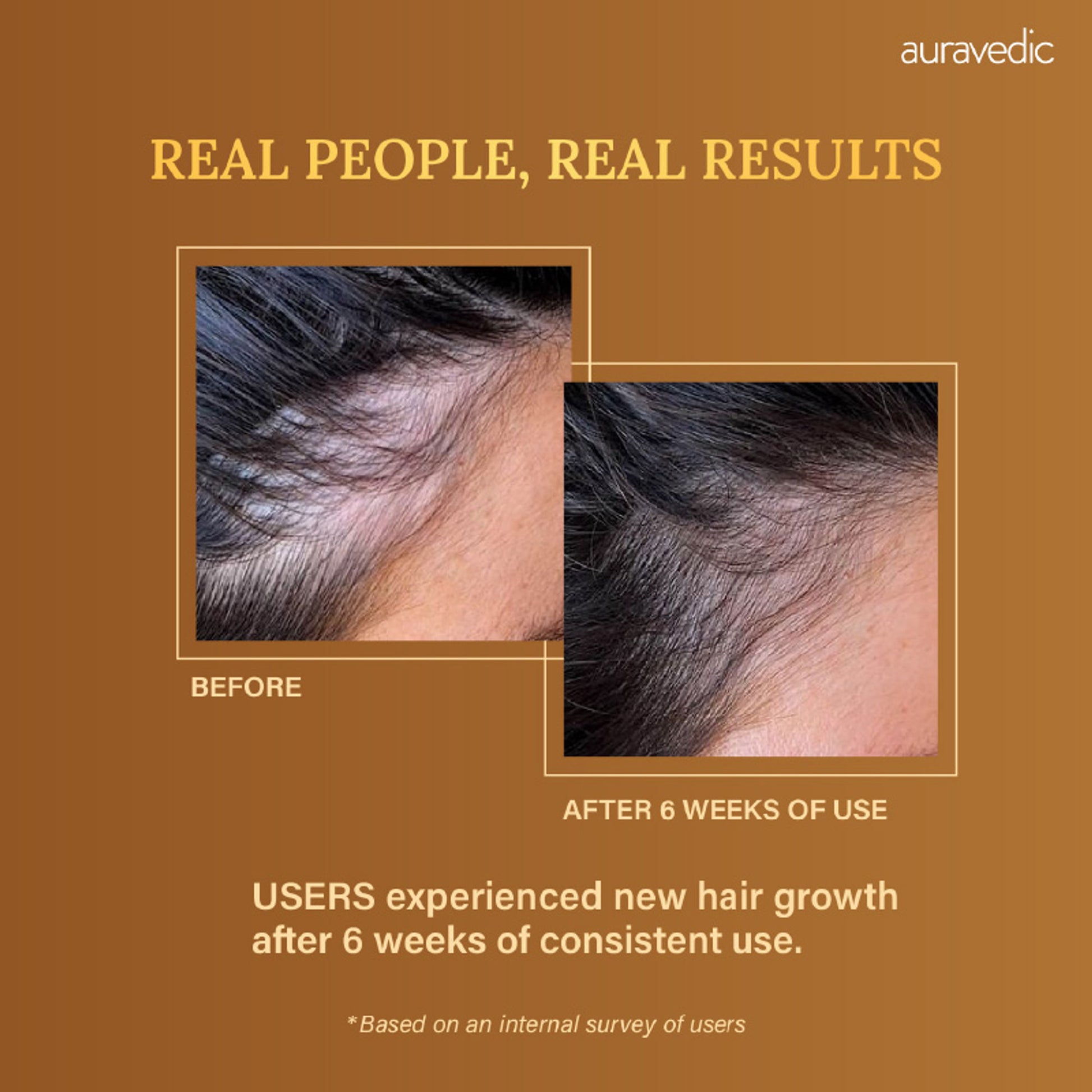 Auravedic Rosemary Hair Oil for Hair Fall with Rosemary Oil for Hair Growth