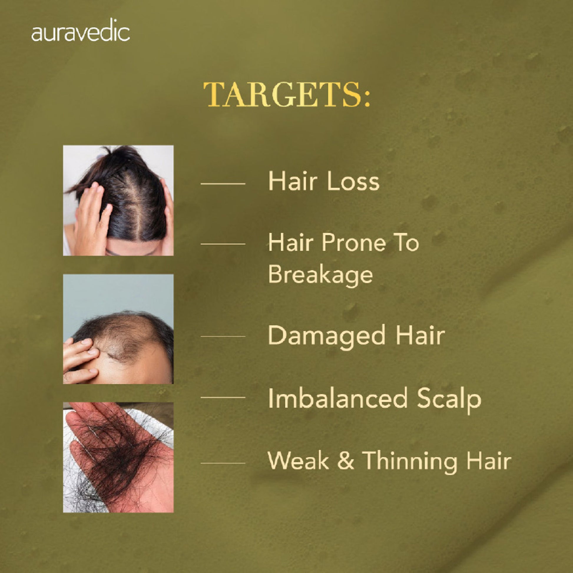 Auravedic Rosemary Shampoo For Hair Growth Anti Hair fall control shampoo