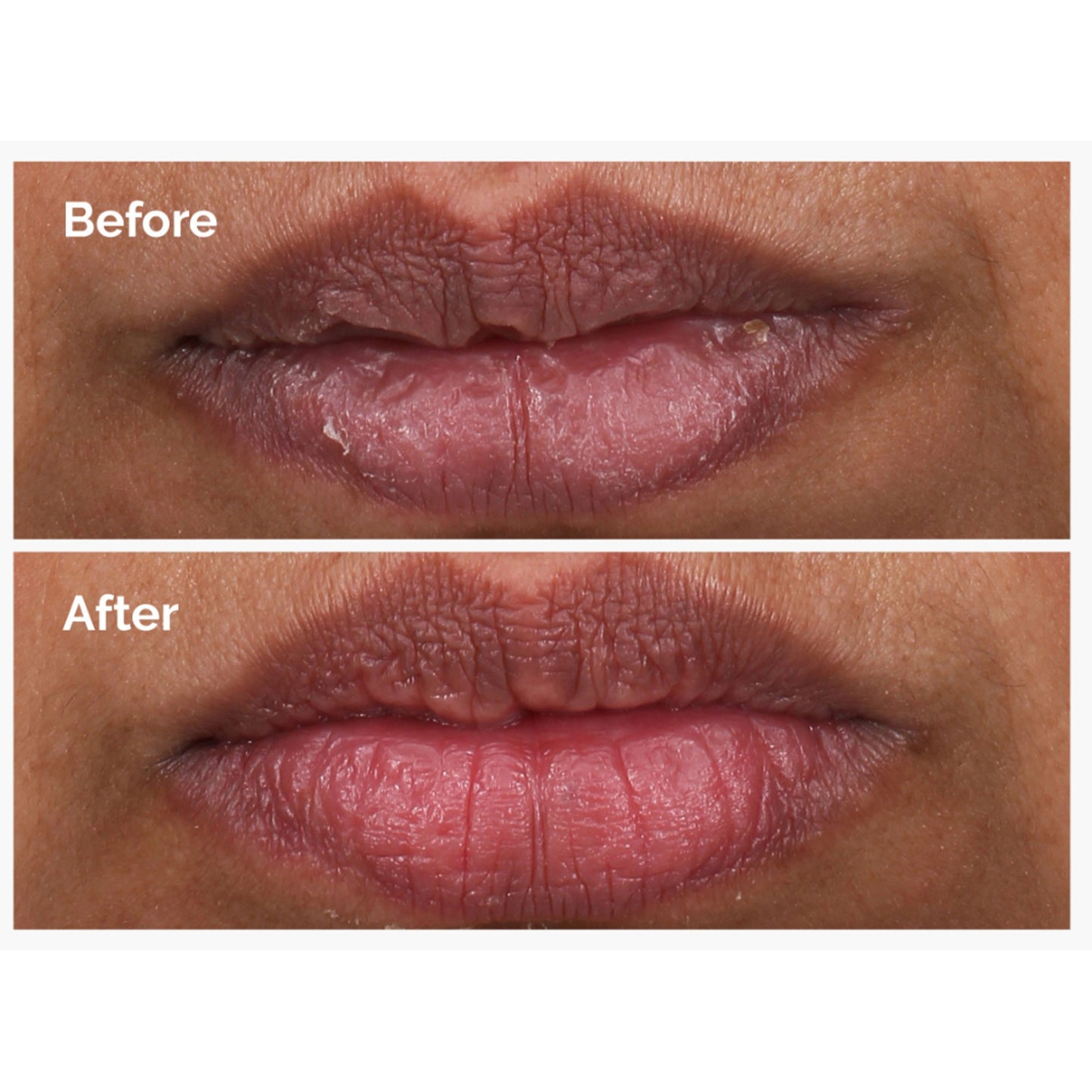 The Ordinary Pha 5% Lip Exfoliating Lip Serum