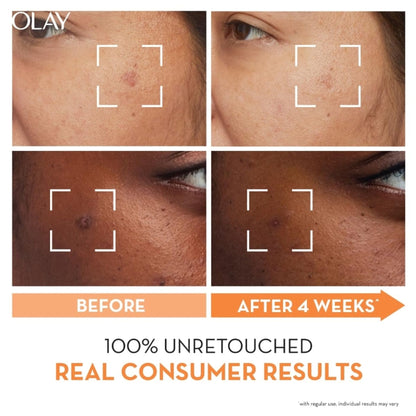 Olay Luminous Niacinamide and Vitamin C Moisturiser