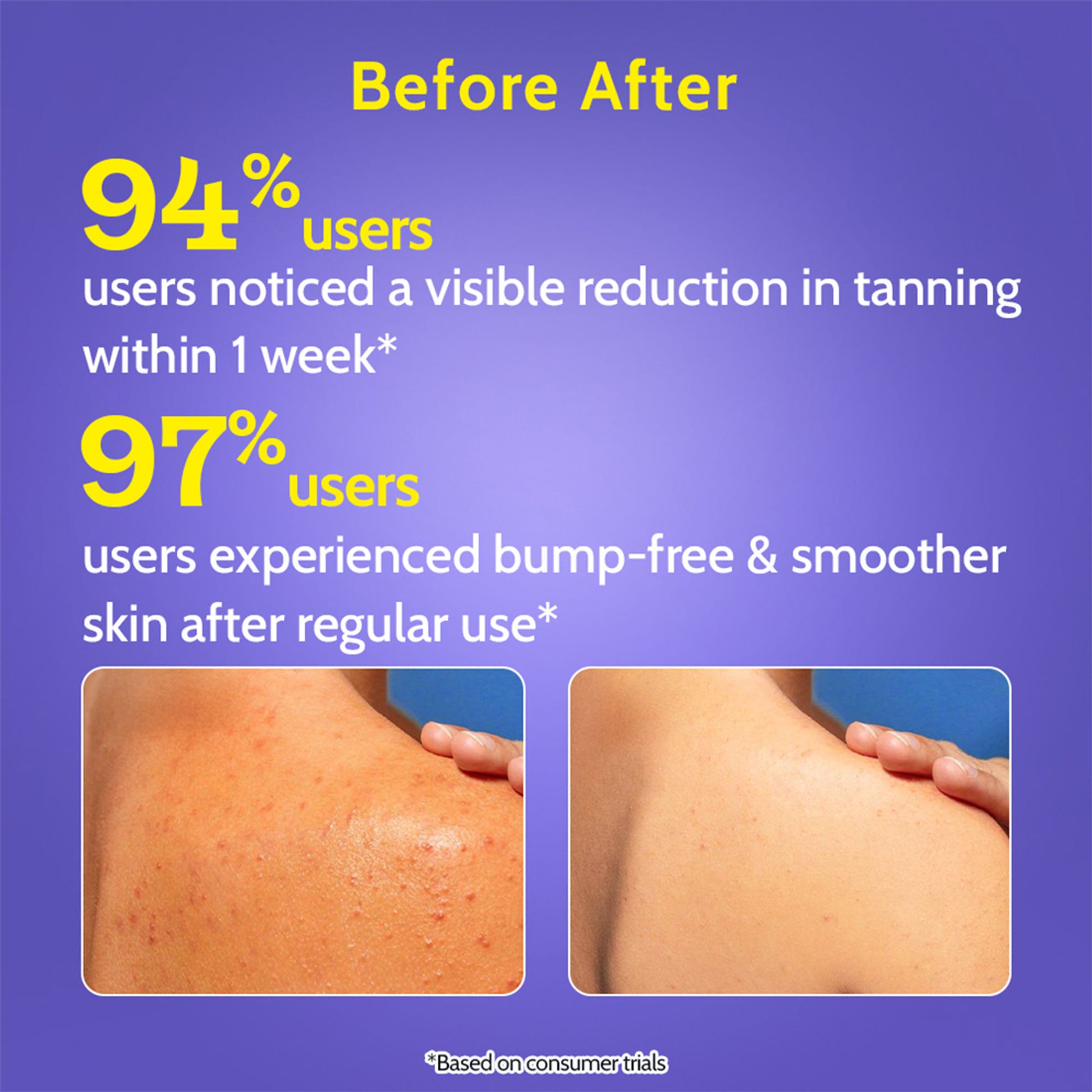 Chemist At Play Exfoliating Body Wash with 4% Lactic Acid, Salicylic Acid & Vit E, Treats Back Acne