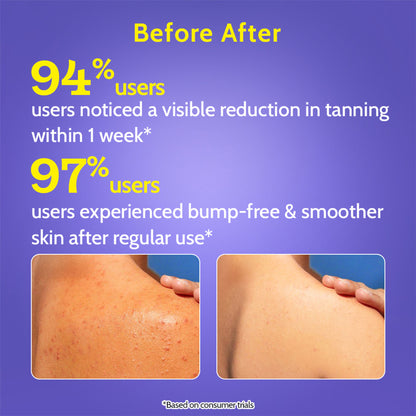Chemist At Play Exfoliating Body Wash with 4% Lactic Acid, Salicylic Acid & Vit E, Treats Back Acne