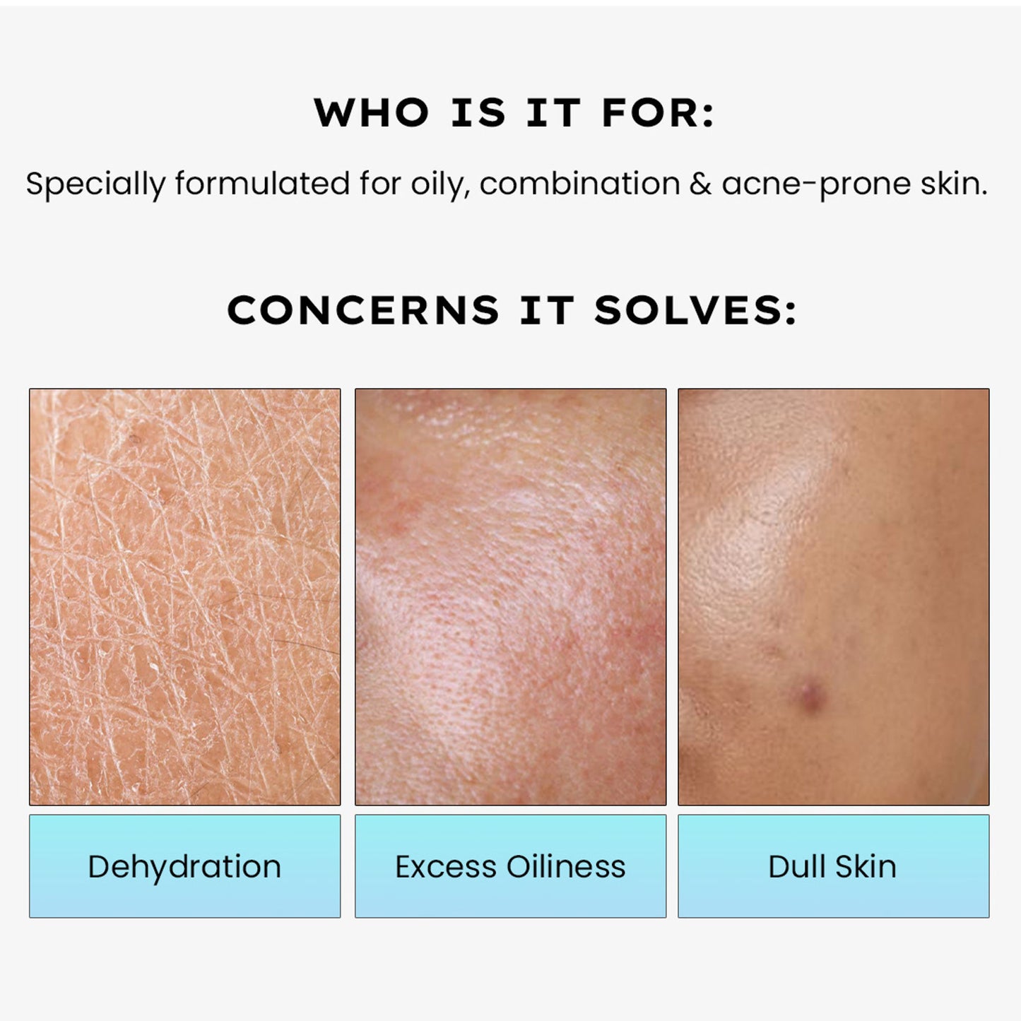 Hyphen 2% Cica Exosome Oil-Free Moisturizer 5% Niacinamide Controls Oil Non-sticky, Light Gel