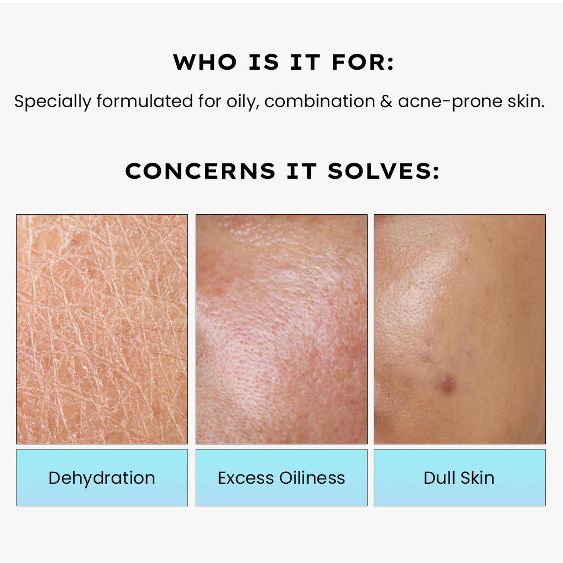 Hyphen 2% Cica Exosome Oil-Free Moisturizer 5% Niacinamide Controls Oil Non-sticky, Light Gel