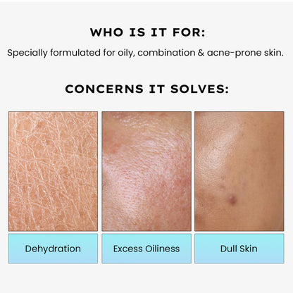 Hyphen 2% Cica Exosome Oil-Free Moisturizer 5% Niacinamide Controls Oil Non-sticky, Light Gel