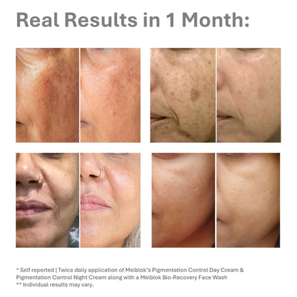 Melblok Pigmentation Control Day & Night System - SPF 50+, PA++++