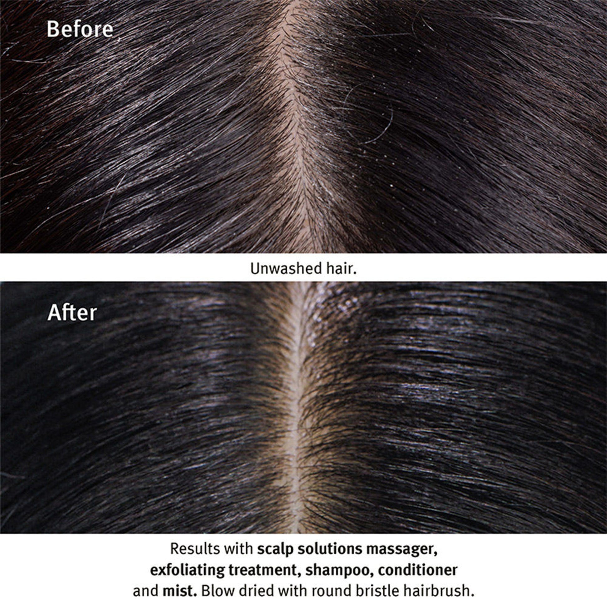Aveda Scalp Solutions Shampoo - Boosts Scalp Hydration by 92%