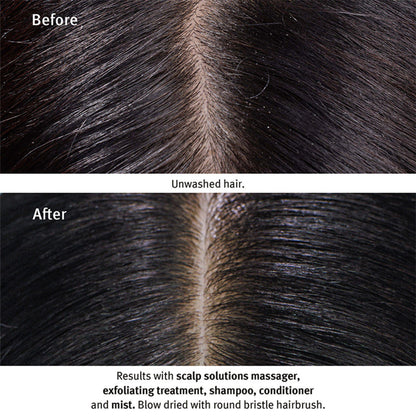 Aveda Scalp Solutions Shampoo - Boosts Scalp Hydration by 92%