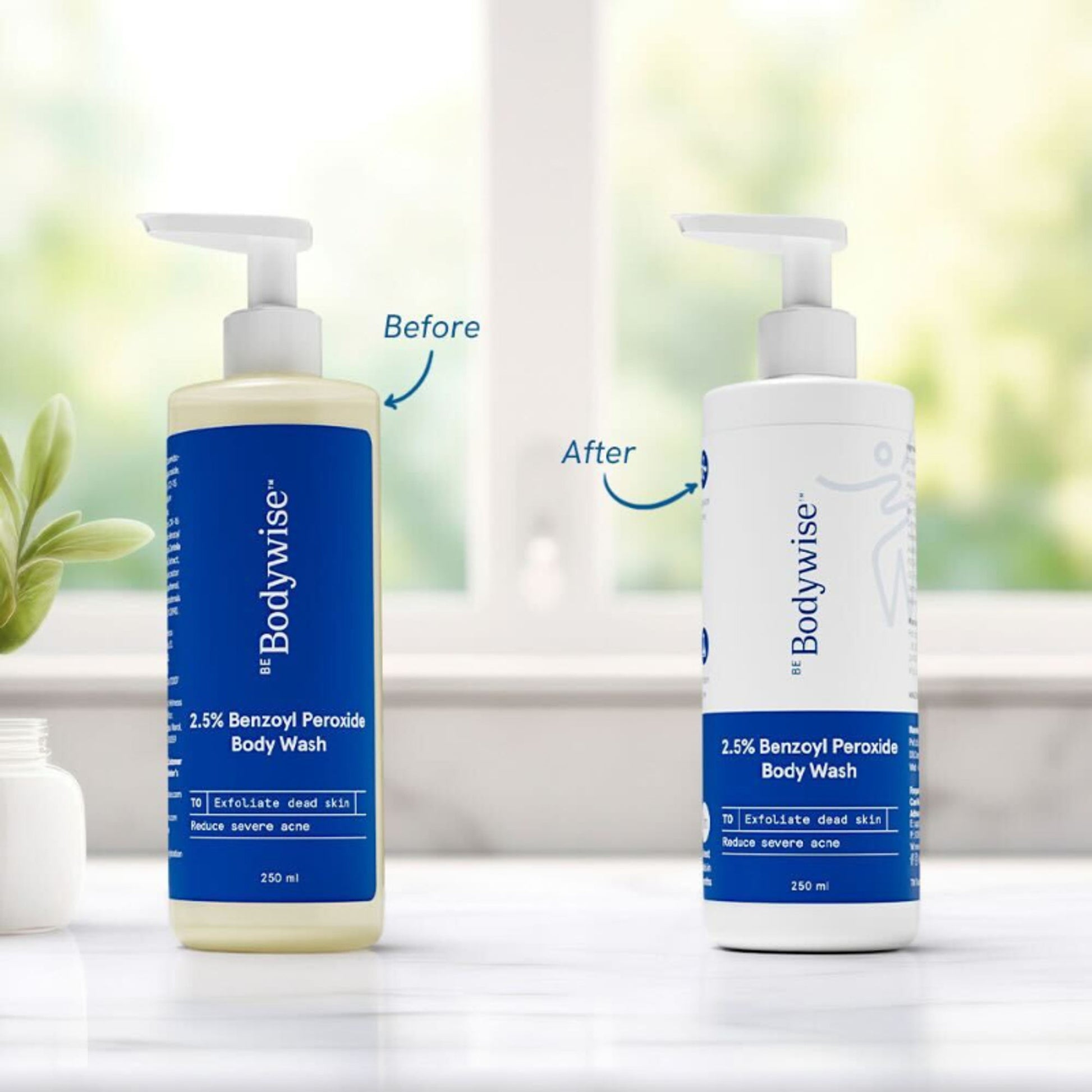 Be Bodywise 2.5% Benzoyl Peroxide Body Wash Treats Stubborn Back Acne