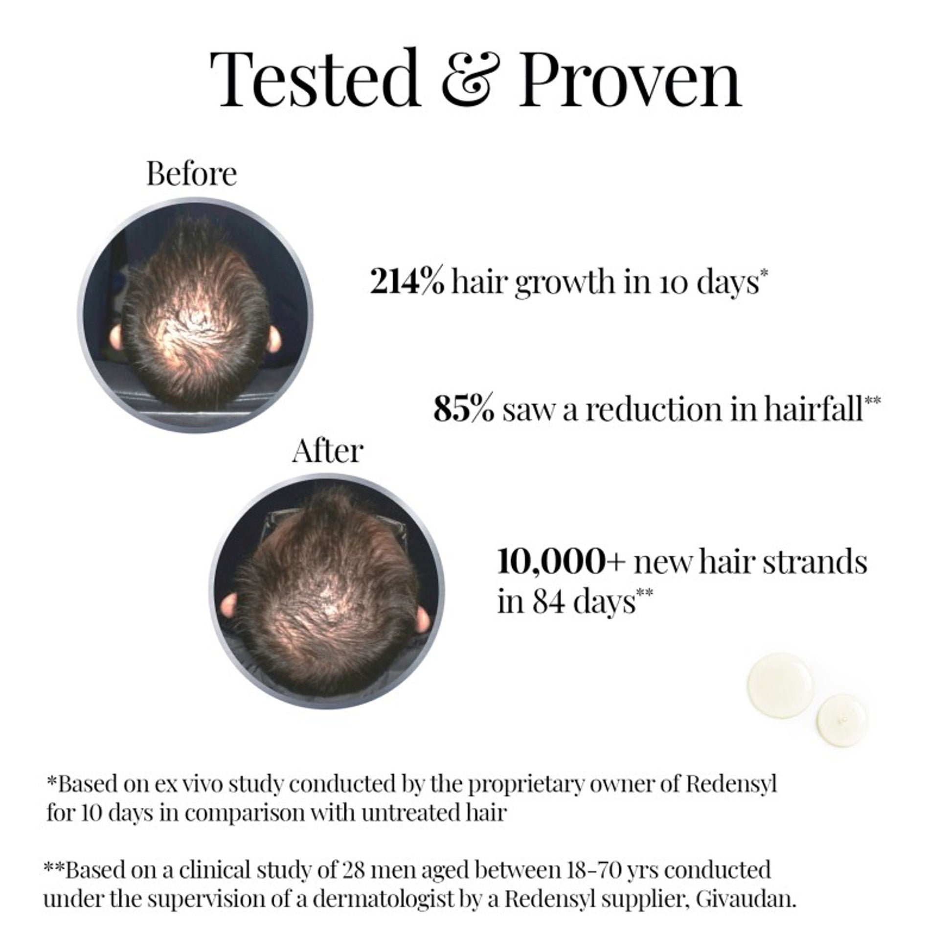 iCosmetiques Hair Revival Serum - 3% Redensyl, 3% Procapil, 3% Anagain & 3% Biacapil