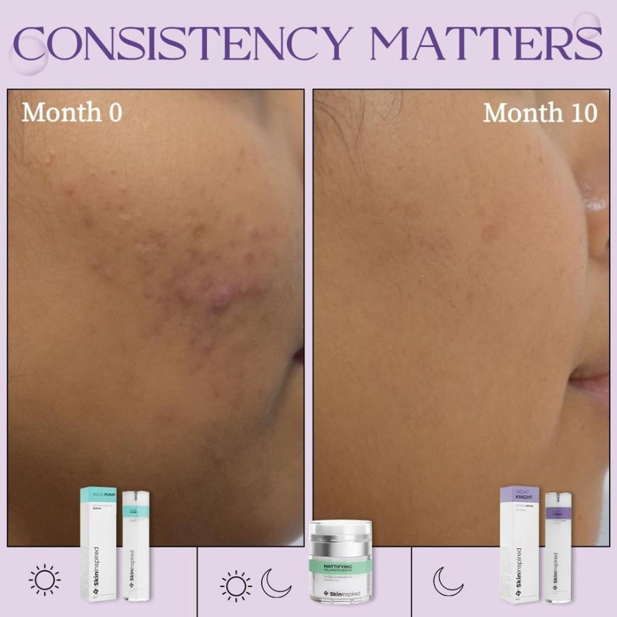 SkinInspired Retinol Face Night Serum