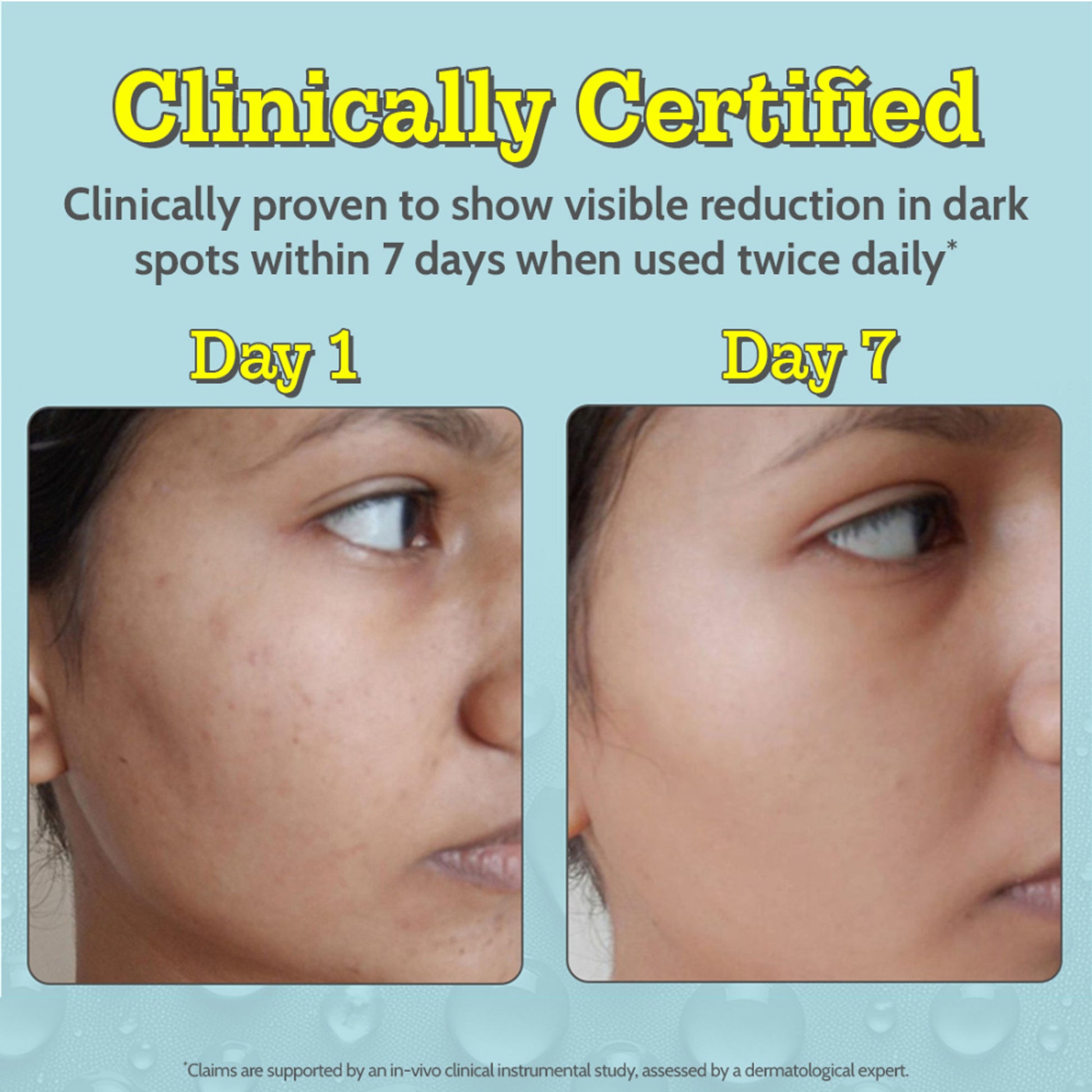 Chemist at Play 10% Vitamin C Face Serum Brightens Skin Treats Dark Spots & Hyperpigmentation