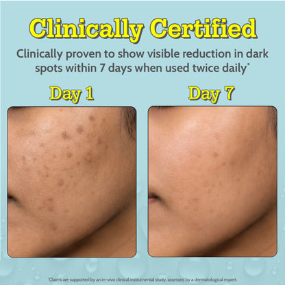 Chemist at Play 10% Vitamin C Face Serum Brightens Skin Treats Dark Spots & Hyperpigmentation