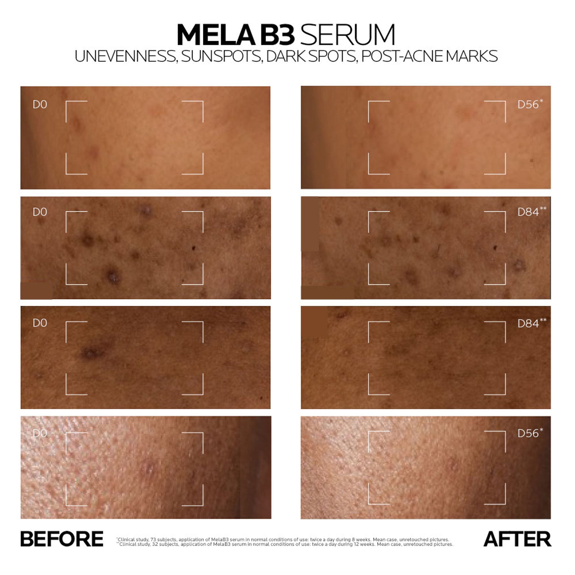La Roche-Posay Mela B3 Serum