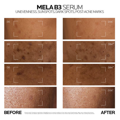 La Roche-Posay Mela B3 Serum