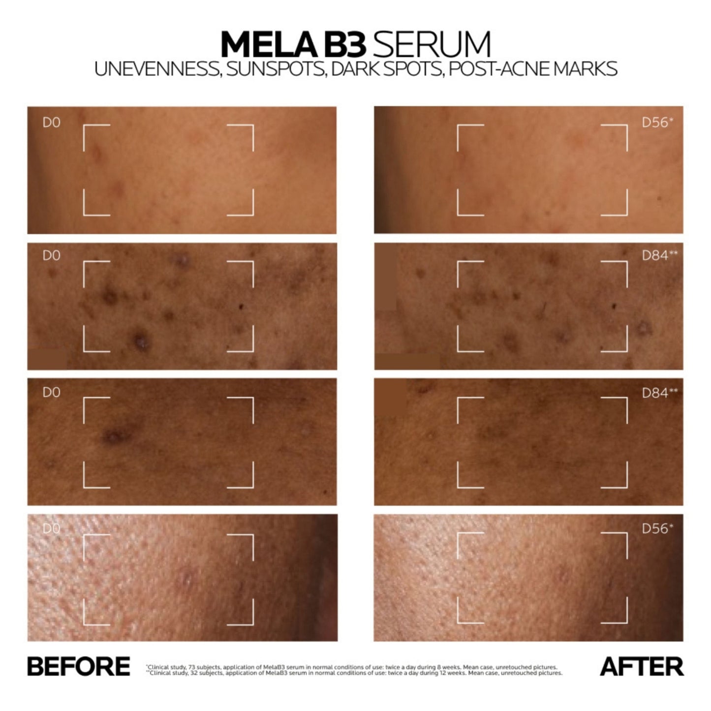 La Roche-Posay Mela B3 Serum