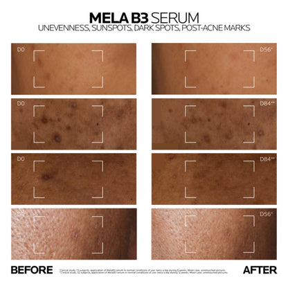 La Roche-Posay Mela B3 Serum