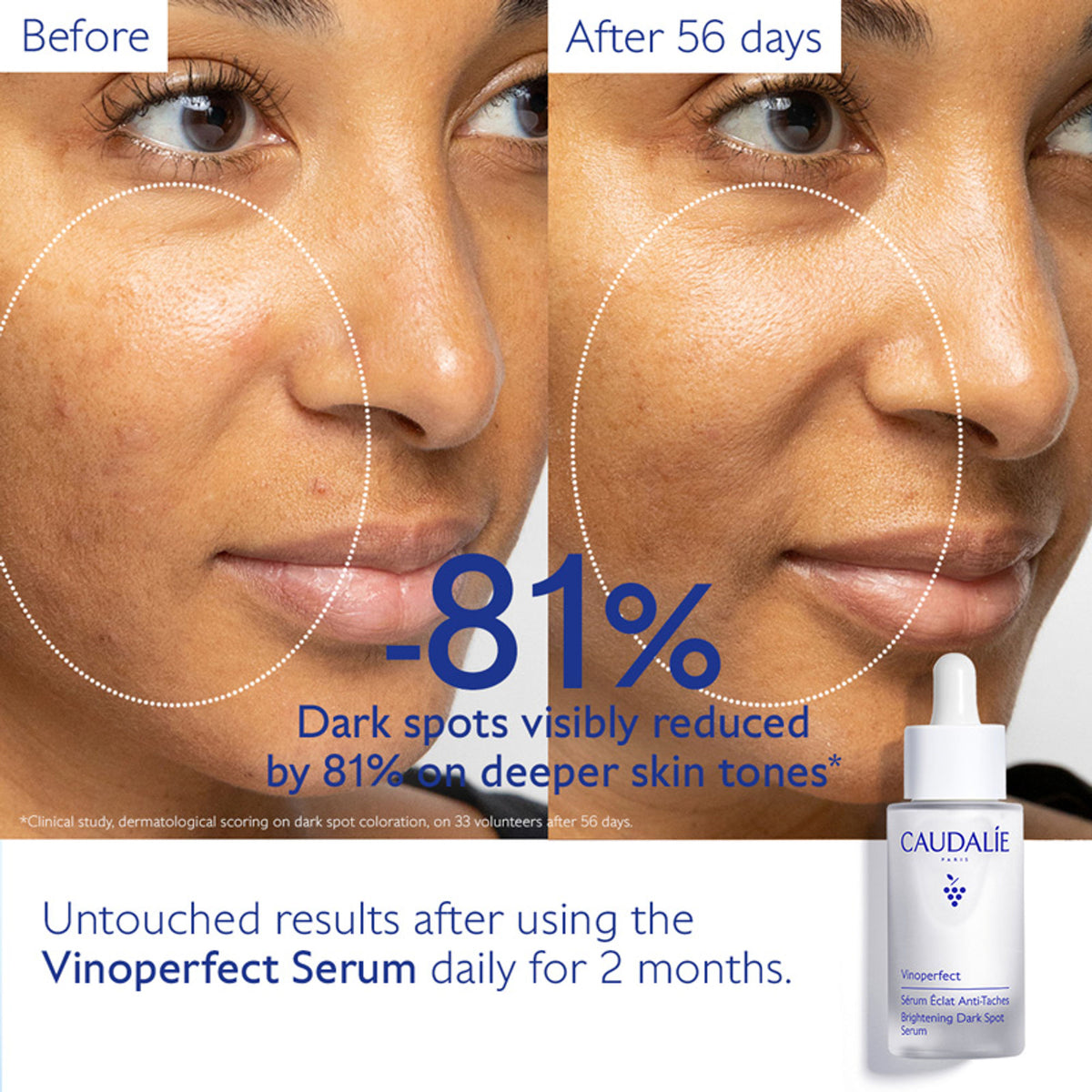 Caudalie Vinoperfect Brightening Dark Spot Serum