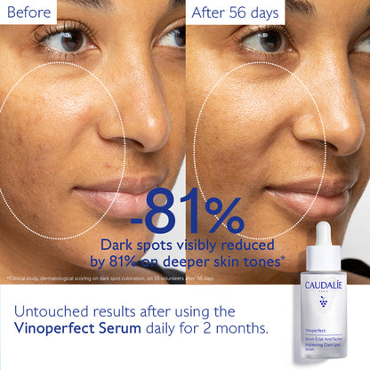 Caudalie Vinoperfect Brightening Dark Spot Serum