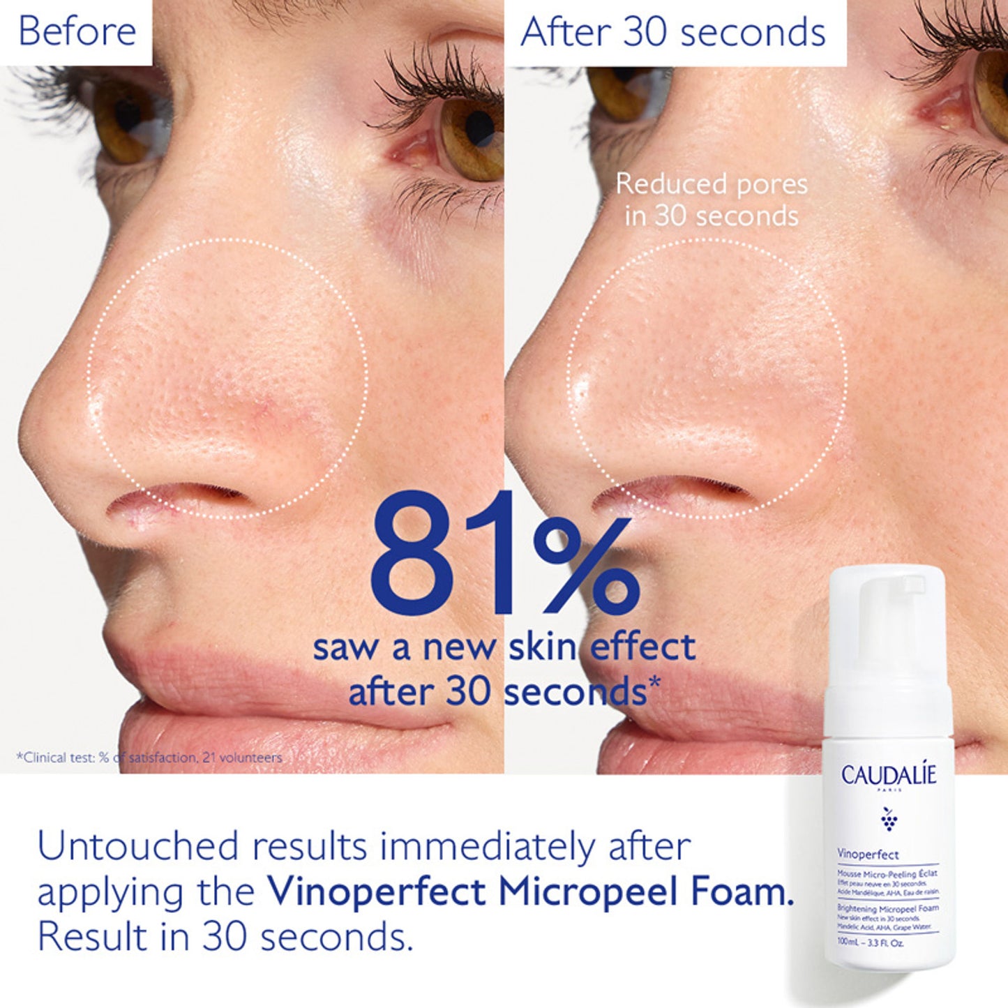 Caudalie Vinoperfect Instant Brightening Micropeel
