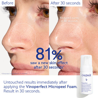 Caudalie Vinoperfect Instant Brightening Micropeel