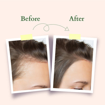 Lotus Organics Hair Fall Control Shampoo